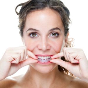 woman placing clear aligners in mouth